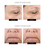 NuFACE Fix Line Smoothing Device
