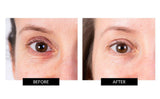 Nira Skincare Laser