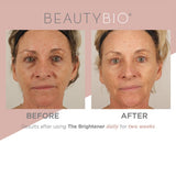 BeautyBio The Brightener